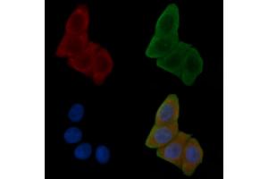 ABIN6257678 and ABIN6275591 staining Hela cells(24h of starvation treatment) by IF/ICC.