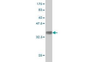 Western Blot detection against Immunogen (35. (DLG1 antibody  (AA 1-90))