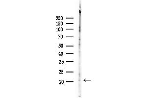Western blot analysis of lysates from COLO205 cells(heat-shock,45 min treatment), using ARL4C Antibody at 1/1000 dilution.