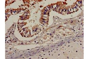 Immunohistochemistry analysis of human lung tissue using ABIN7145942 at dilution of 1:100 (CCR7 antibody  (AA 332-378))