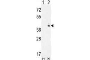 Western Blotting (WB) image for anti-Galactokinase 1 (GALK1) antibody (ABIN3002977)
