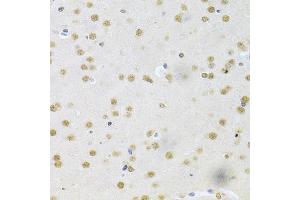 Immunohistochemistry (IHC) image for anti-Core-Binding Factor, beta Subunit (CBFB) (AA 1-182) antibody (ABIN6138000)