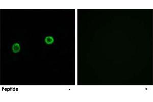 Immunofluorescence analysis of MCF-7 cells, using ACOT4 polyclonal antibody . (ACOT4 antibody)