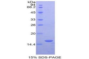 SDS-PAGE analysis of Mouse RBP3 Protein. (RBP3 Protein)
