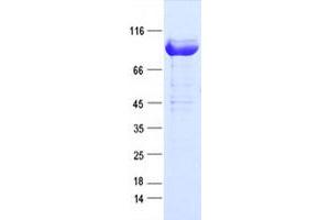 Western Blotting (WB) image for Protein Kinase C, epsilon (PRKCE) protein (DYKDDDDK Tag) (ABIN2729625)