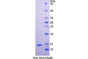 SDS-PAGE analysis of Mouse NEFL Protein. (Neurofilament, Light Polypeptide (NEFL) Peptide)