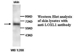 Image no. 1 for anti-Lysyl Oxidase-Like 1 (LOXL1) antibody (ABIN790876) (LOXL1 antibody)