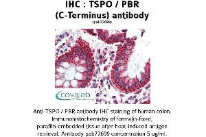 Image no. 2 for anti-Peripheral-Type Benzodiazepine Receptor (TSPO) (C-Term) antibody (ABIN1740430) (TSPO antibody  (C-Term))