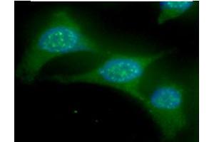 ICC/IF analysis of UBE2L6 in HeLa cells line, stained with DAPI (Blue) for nucleus staining and monoclonal anti-human UBE2L6 antibody (1:100) with goat anti-mouse IgG-Alexa fluor 488 conjugate (Green). (UBE2L6 antibody)