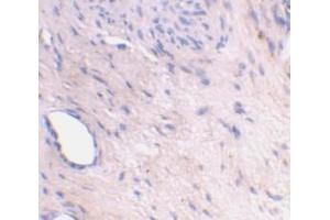 Immunohistochemical staining of human bladder tissue using AP30081PU-N ARMER antibody at 2 μg/ml. (ARL6IP1 antibody  (C-Term))