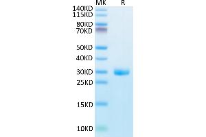 Human BTN3A1 on Tris-Bis PAGE under reduced condition. (BTN3A1 Protein (AA 30-254) (His tag))