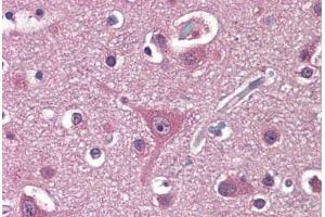 Human Brain, Cortex: Formalin-Fixed, Paraffin-Embedded (FFPE) (PPAT antibody  (AA 42-278))