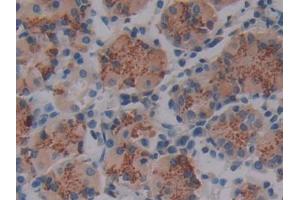 DAB staining on IHC-P; Samples: Human Stomach Tissue (LOXL4 antibody  (AA 479-756))