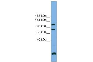 WB Suggested Anti-PPP6R1 Antibody Titration: 0. (SAPS1 antibody  (N-Term))