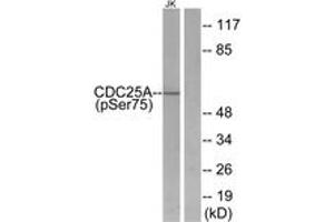 Western Blotting (WB) image for anti-Cell Division Cycle 25 Homolog A (S. Pombe) (CDC25A) (pSer75) antibody (ABIN2888378) (CDC25A antibody  (pSer75))