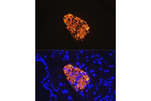 Immunofluorescence analysis of rat pancreas using Insulin Rabbit mAb (ABIN7267886) at dilution of 1:100 (40x lens). (Insulin antibody)