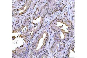 IHC analysis of FEN1 using anti-FEN1 antibody (ABIN7601617).