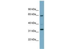 ZNF791 anticorps  (AA 35-84)