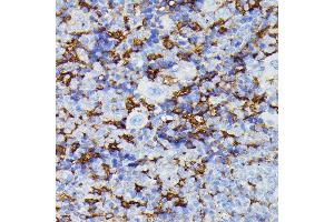Immunohistochemistry (IHC) image for anti-Matrix Metallopeptidase 25 (MMP25) (AA 350-540) antibody (ABIN7268422)