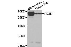 Western Blotting (WB) image for anti-PDZ Domain Containing 1 (PDZK1) antibody (ABIN1876509) (PDZK1 antibody)