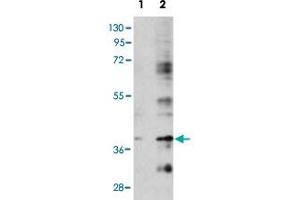 Western blot analysis of BIRC7 (arrow) using rabbit BIRC7 polyclonal antibody .