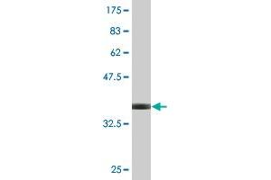 Western Blot detection against Immunogen (36. (DAB2 antibody  (AA 673-770))