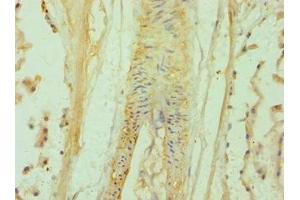 Immunohistochemistry of paraffin-embedded human prostate tissue using ABIN7145641 at dilution of 1:100