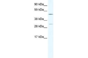 CAMK4 antibody (20R-1131) used at 1. (CAMK4 antibody  (C-Term))