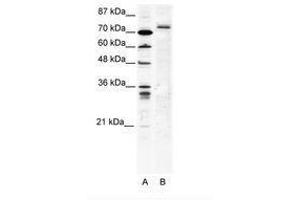 Image no. 1 for anti-Tripartite Motif Containing 9 (TRIM9) (C-Term) antibody (ABIN202749) (TRIM9 antibody  (C-Term))