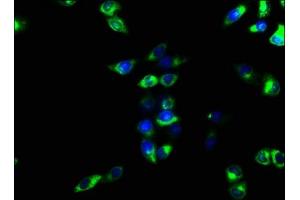 Immunofluorescence staining of Hela cells with ABIN7151367 at 1:166, counter-stained with DAPI. (CD39 antibody  (AA 316-474))