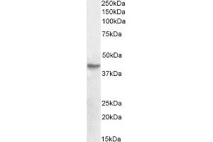 Immunohistochemistry (IHC) image for anti-Forkhead Box L2 (FOXL2) (C-Term) antibody (ABIN185040)