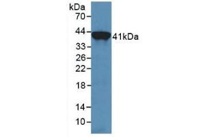 WB of Protein Standard: different control antibodies against Highly purified E. (Transferrin ELISA Kit)