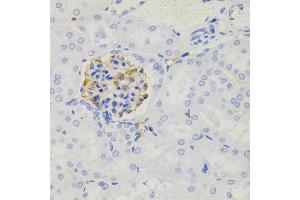 Immunohistochemistry of paraffin-embedded mouse kidney using NPHS1 antibody (ABIN5971560) (40x lens). (Nephrin antibody)