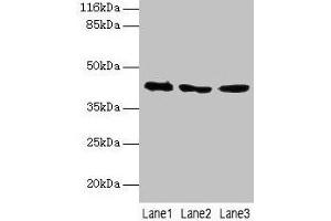 Western blot All lanes: ATXN3 antibody at 2 μg/mL Lane 1: 293T whole cell lysate Lane 2: Mouse brain tissue Lane 3: MCF-7 whole cell lysate Secondary Goat polyclonal to rabbit IgG at 1/10000 dilution Predicted band size: 42, 36, 40, 21 kDa Observed band size: 42 kDa (Ataxin 3 antibody  (AA 1-288))