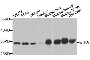 Western blot analysis of extracts of various cell lines, using ETFA antibody. (ETFA antibody  (AA 1-333))