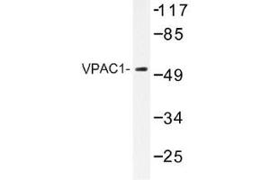 Image no. 1 for anti-Vasoactive Intestinal Peptide Receptor 1 (VIPR1) antibody (ABIN317871) (VIPR1 antibody)