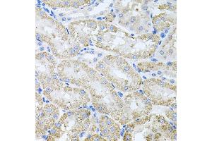 Immunohistochemistry of paraffin-embedded mouse kidney using TARS antibody (ABIN5974207) at dilution of 1/100 (40x lens). (TARS antibody)