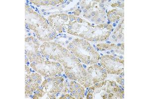 Immunohistochemistry of paraffin-embedded mouse kidney using TARS antibody (ABIN5974207) at dilution of 1/100 (40x lens). (TARS antibody)