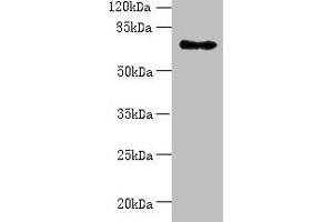 Western blot All lanes: ZNF133 antibody at 5 μg/mL + Hela whole cell lysate Secondary Goat polyclonal to rabbit IgG at 1/10000 dilution Predicted band size: 74, 63, 67 kDa Observed band size: 74 kDa (ZNF133 antibody  (AA 1-210))