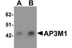 Western blot analysis of AP3M1 in human brain tissue lysate with AP3M1 antibody at (A) 1 and (B) 2 μg/ml. (AP3M1 antibody  (C-Term))