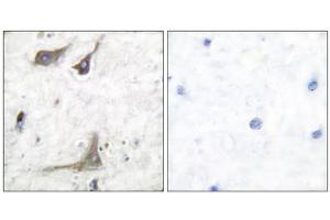 Immunohistochemical analysis of paraffin-embedded human brain tissue using PTGS1 antibody (ABIN5976368). (PTGS1 antibody  (C-Term))