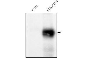 Western Blotting (WB) image for anti-Fms-Related Tyrosine Kinase 4 (FLT4) antibody (ABIN567980) (FLT4 antibody)
