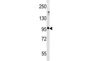 Western blot analysis of mGLUR5 antibody and mouse brain tissue lysate (Metabotropic Glutamate Receptor 5 antibody  (AA 1020-1050))
