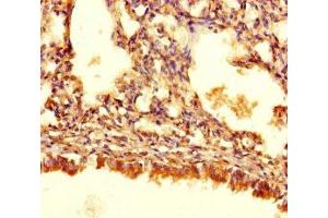 Immunohistochemistry of paraffin-embedded human lung tissue using ABIN7144175 at dilution of 1:100 (ASB1 antibody  (AA 1-300))