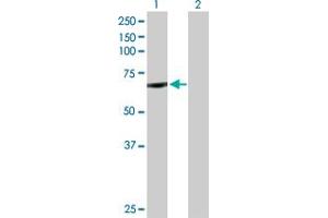 Western Blot analysis of CYP11B1 expression in transfected 293T cell line by CYP11B1 MaxPab polyclonal antibody. (CYP11B1 antibody  (AA 1-574))