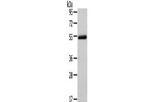 Western Blot analysis of Human normal liver tissue using FOXC1 Polyclonal Antibody at dilution of 1/400 (FOXC1 antibody)