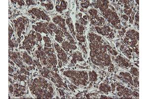 Image no. 6 for anti-Family with Sequence Similarity 164, Member A (FAM164A) antibody (ABIN1498198) (FAM164A antibody)