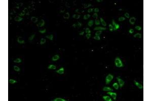 Detection of P4Ha2 in Human Hela Cells using Polyclonal Antibody to Prolyl-4-Hydroxylase Alpha Polypeptide II (P4Ha2) (P4HA2 antibody  (AA 207-520))