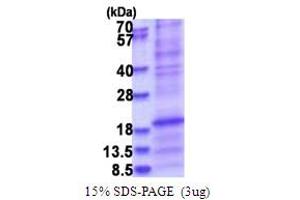 Surfactant Protein D (SFTPD) (AA 224-375) protein (His tag)