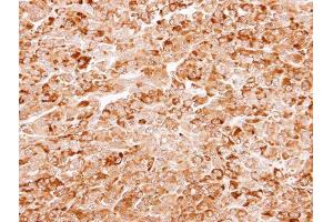 IHC-P Image Immunohistochemical analysis of paraffin-embedded CL1-5 xenograft, using AKR7A3, antibody at 1:100 dilution. (AKR7A3 antibody)